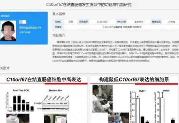 小学生研究癌症获奖 组委会回应已经展开调查