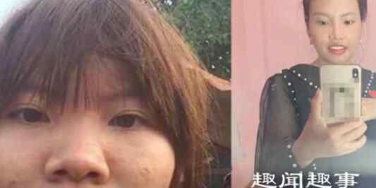 离异女子整容后嫁富商,怀孕6个月后样貌大变,网友担心孩子颜值