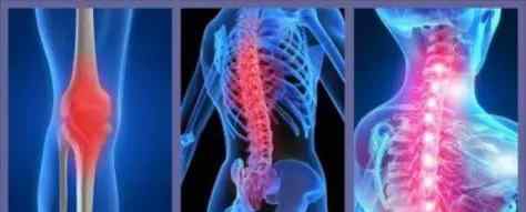 脊椎炎能治愈吗 强直性脊柱炎可以根治吗?