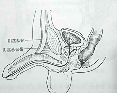 延长阴茎 总是觉得丁丁不够长？阴茎延长术有必要做吗？