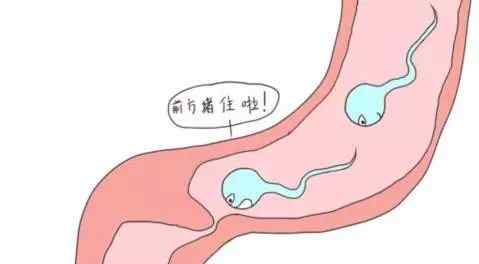 去医院结扎要多少钱 北京不孕不育医院：输卵管结扎复通手术需要多少钱 ？