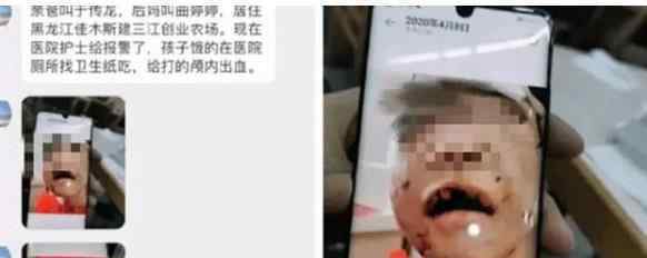 黑龙江虐童案生父继母被批捕 究竟发生了什么