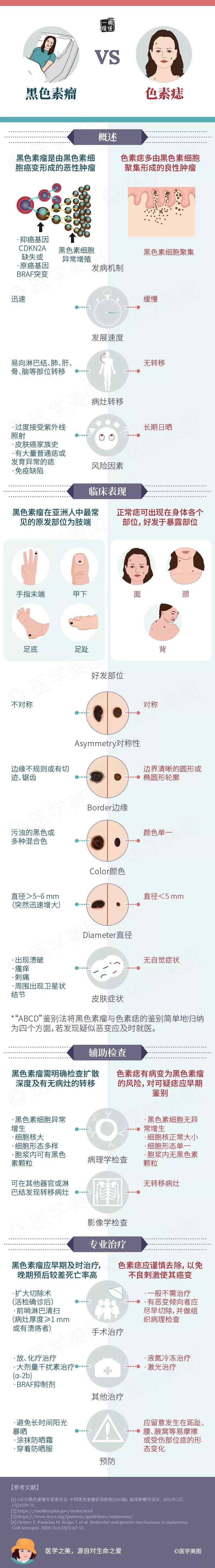 黑色素瘤早期症状图片 读图 ｜ 黑色素瘤和色素痣，一图让你分得明明白白！