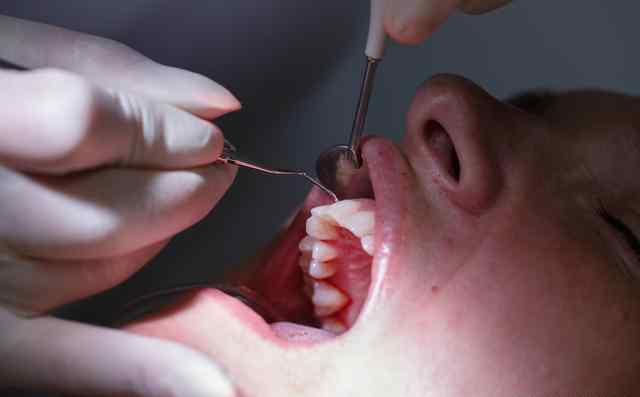 牙周宁 牙周炎常用治疗药物（附联合用药）