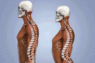 脊梁骨 脊柱养生
