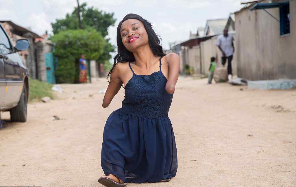 津巴布韦:四肢残疾的美发师Sinikiwe Kademaunga