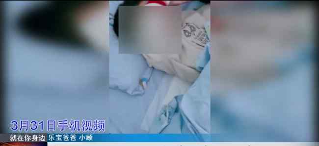 武汉一男童在幼儿园期间下体受伤 具体是什么情况？