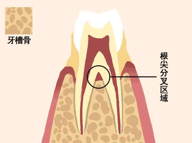 如何让摇晃牙脱落 一张动图告诉你，牙齿是如何脱落的……