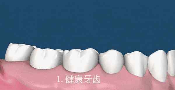 牙齿老是出血是什么原因 刷牙经常出血是什么原因造成的？