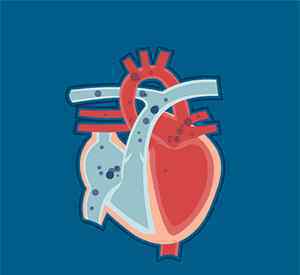 左心房增大是什么原因 心脏瓣膜和心脏功能都正常，但是心房增大了，这意味着什么？