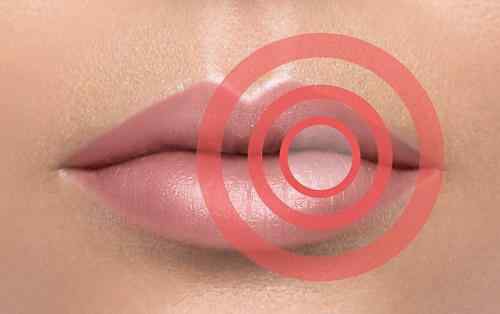 唇炎症状 唇炎的基本症状有哪些?