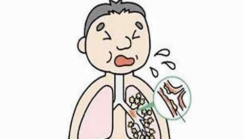 气管炎症状 什么是气管炎？气管炎的症状是什么？