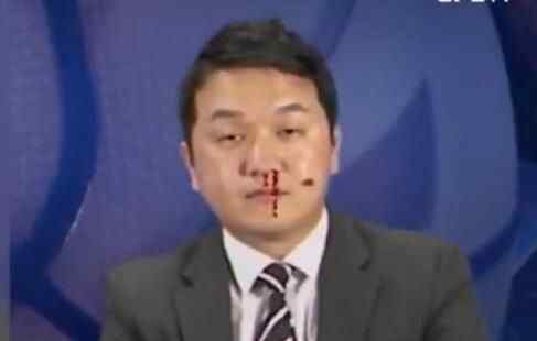 韩国解说员流鼻血 究竟是怎么回事？
