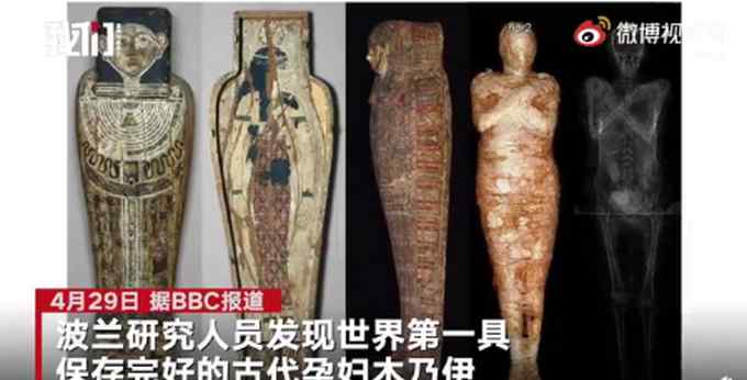 世界第一具！波兰发现2000年前孕妇木乃伊 腹中胎儿清晰可见