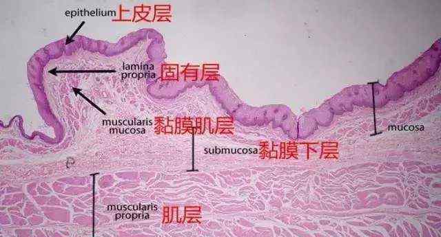 有胃病的人如何养胃 胃病总是反反复复？手把手教你如何养胃