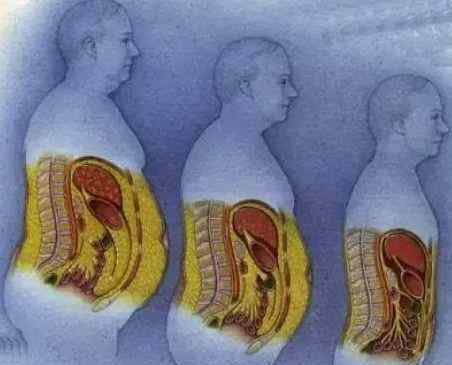 BBC女子解剖 BBC解剖了一个214斤的女子，看完你会用生命去减肥！