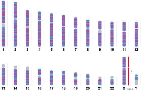 男方染色体异常的表现 性染色体异常：你看到的也许只是表面