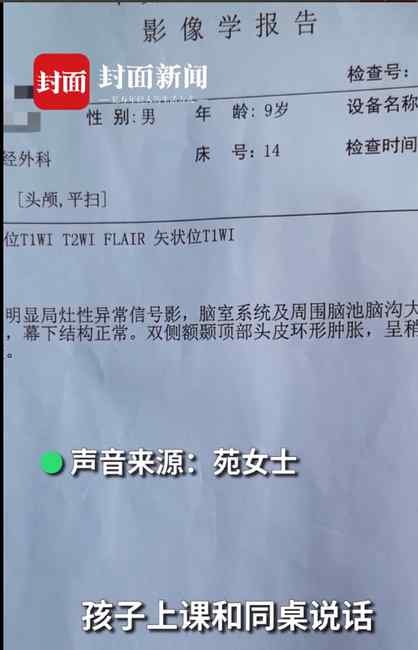 小学生被老师揪头发罚站致皮骨分离 家长：10多天后老师才被停课