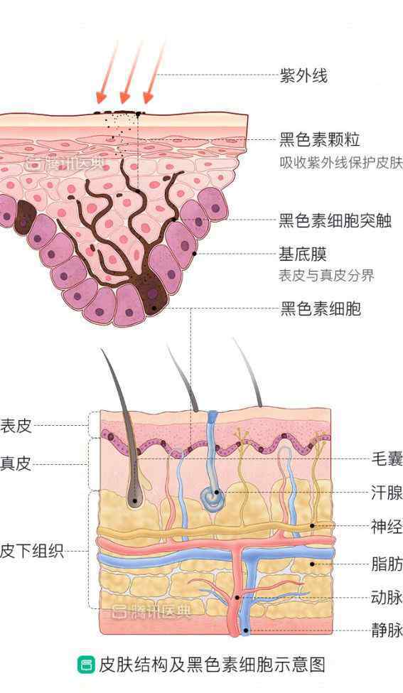 脸上很多斑 脸上色斑显老又难看？医生提醒：2个方法收好，你就少长斑