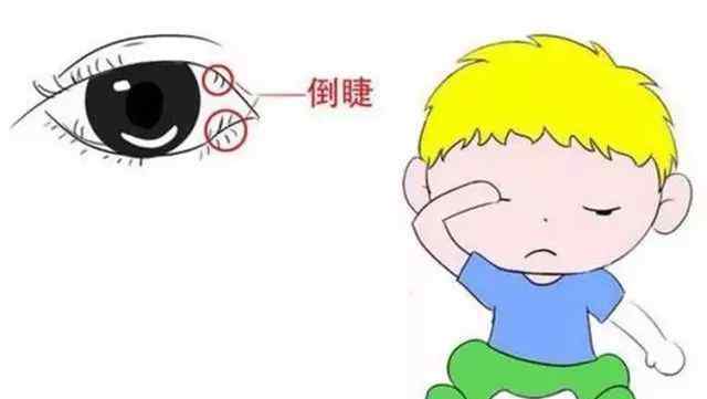 宝宝眼睛有眼屎是黄浓状怎么办 宝宝眼屎多，是什么情况？