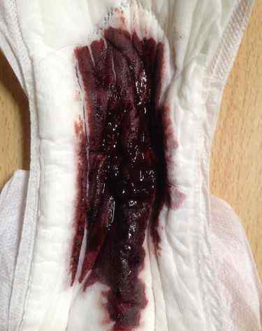正常月经血图片 用月经血涂上照片让人倒霉真假，如果沾了月经血倒霉怎么办？