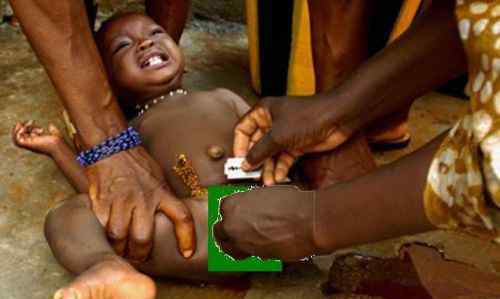 女性割礼后痊愈图片 非洲残忍割礼女人后的图片，非洲为什么这么落后原因分析