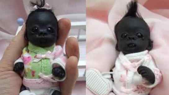 黑宝宝 “世界最黑宝宝”，出生黑成一块碳，如今7岁变这样了