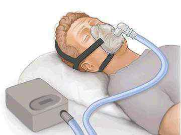 家用呼吸机谁用过 家用呼吸机适合哪些人群？