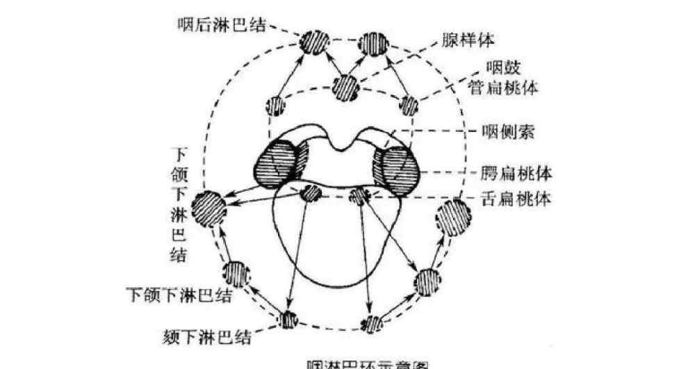 扁桃体发炎高烧不退怎么办 家长们注意了，扁桃体反复发炎、高烧不退，原因很有可能是这个