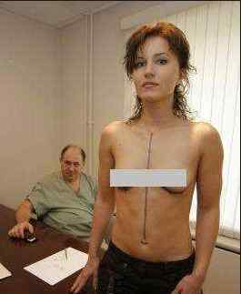 伪娘隆胸的全过程视频 震撼实拍美女隆胸过程，实拍美女隆胸手术视频