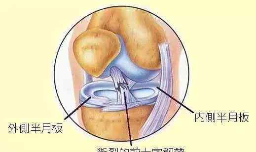 锻炼膝盖最好的方法 15个膝关节实用康复锻炼方法