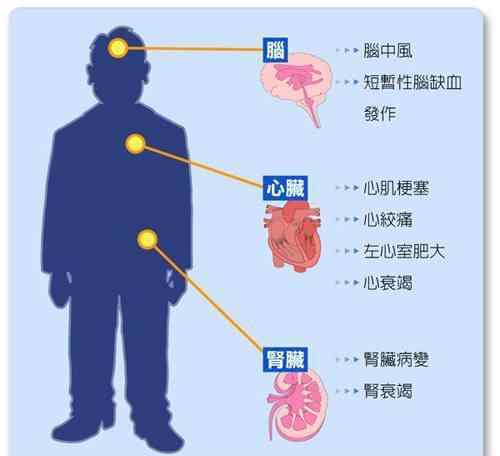 血压的低压高怎么办 血压只是高压或者低压高，需要治疗吗？医生告诉你怎么办