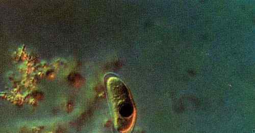 巨型阿米巴虫 生存在海底1万米下的生物 巨型阿米巴虫图片