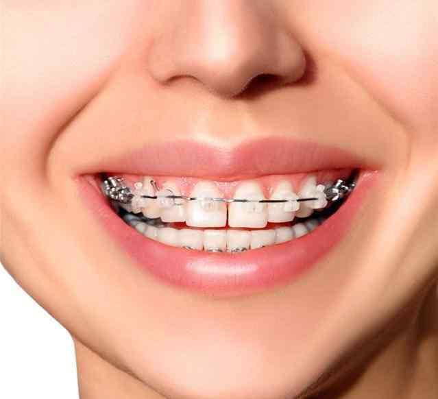 蛀牙可以恢复小窍门 让人闻风丧胆的牙齿黑三角，比蛀牙更可怕！修复方法来了