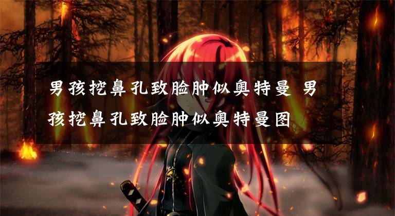 男孩挖鼻孔致脸肿似奥特曼 男孩挖鼻孔致脸肿似奥特曼图文章配图