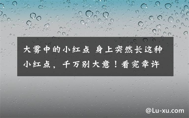 大雾中的小红点 身上突然长这种小红点，千万别大意！看完幸许能躲过一劫！文章配图