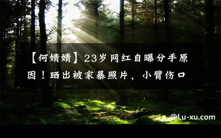 【何婧婧】23岁网红自曝分手原因！晒出被家暴照片，小臂伤口长达几十厘米文章配图