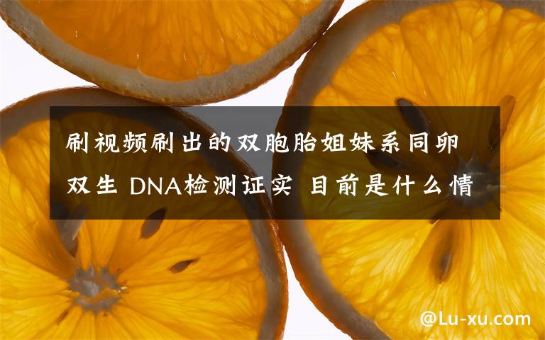 刷视频刷出的双胞胎姐妹系同卵双生 DNA检测证实 目前是什么情况？