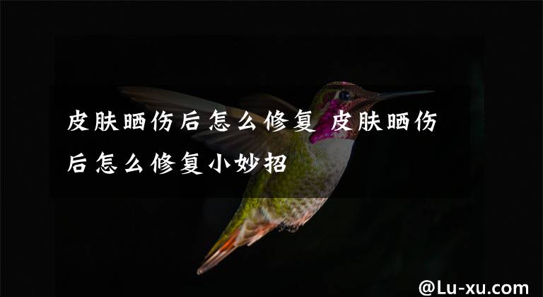 皮肤晒伤后怎么修复 皮肤晒伤后怎么修复小妙招文章配图