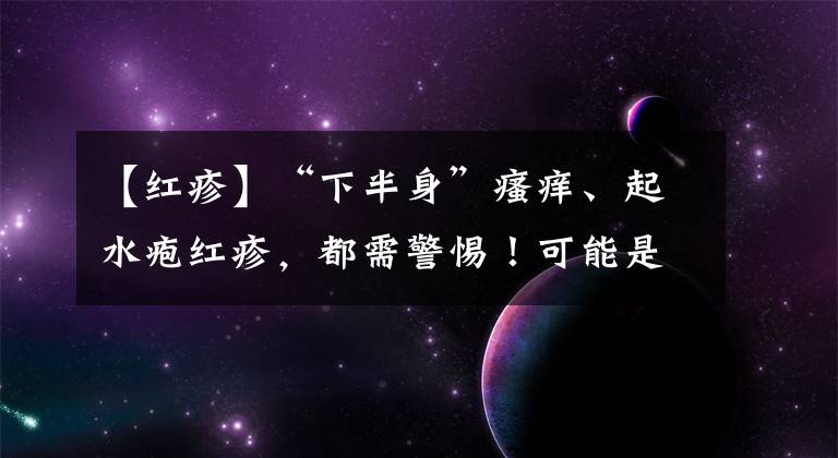 【红疹】“下半身”瘙痒、起水疱红疹，都需警惕！可能是这5种性传播疾病