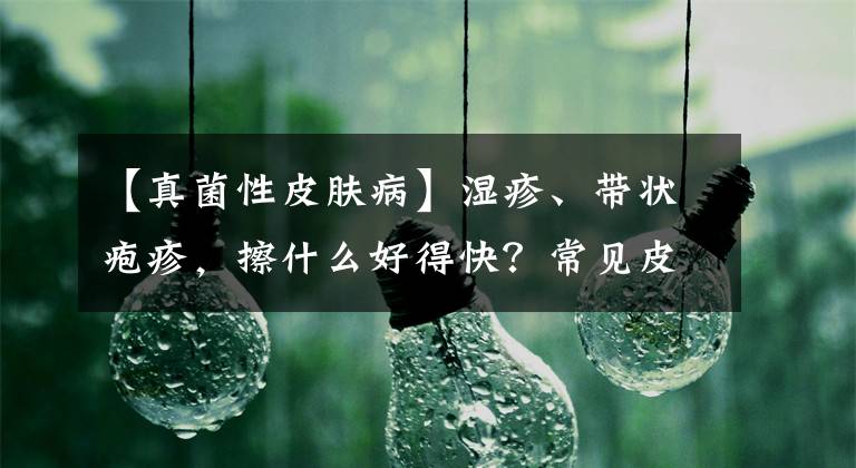 【真菌性皮肤病】湿疹、带状疱疹，擦什么好得快？常见皮肤病「外用药膏」指南来了