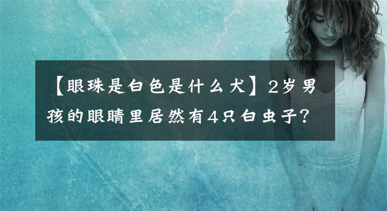 【眼珠是白色是什么犬】2岁男孩的眼睛里居然有4只白虫子？医生警告猫和狗摸完后不要先揉眼睛文章配图