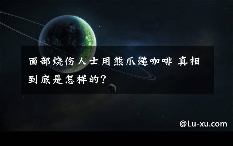 面部烧伤人士用熊爪递咖啡 真相到底是怎样的？