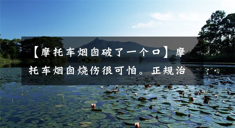 【摩托车烟囱破了一个口】摩托车烟囱烧伤很可怕。正规治疗最重要！文章配图