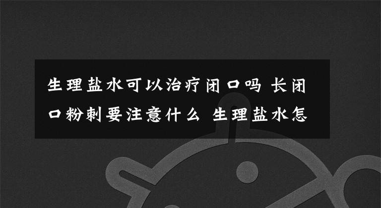 生理盐水可以治疗闭口吗 长闭口粉刺要注意什么 生理盐水怎么治闭口粉刺