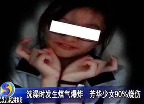 火人 惨不忍睹！少女洗澡煤气爆炸 17岁女孩出来时全身上下已是“火人”