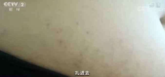 宾馆开房 美容乱象再调查：学了3天就敢操刀上阵，宾馆开房做手术