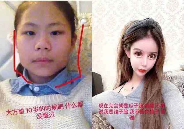 郭晶晶整容 13岁少女沉迷于“整容”，3年内动了60次脸，如今前后判若两人！