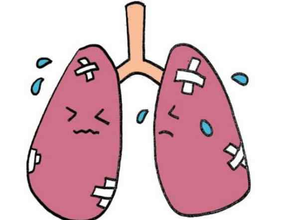 肺炎链球菌肺炎的临床表现 什么是肺炎链球菌肺炎
