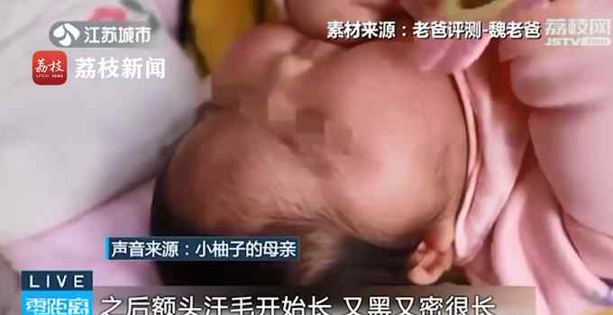 健康女婴用抑菌霜变大头娃娃 还全身长汗毛？涉事企业已停止生产